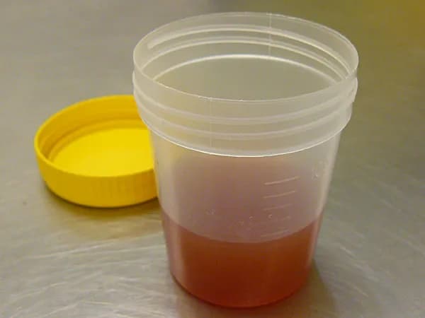 Ciemny mocz u psa: Przyczyny i co robić w takiej sytuacji?